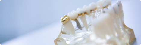 Dentures